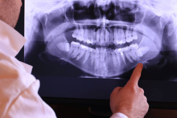 Best Broken or Chipped Tooth Repair in Tulia, TX